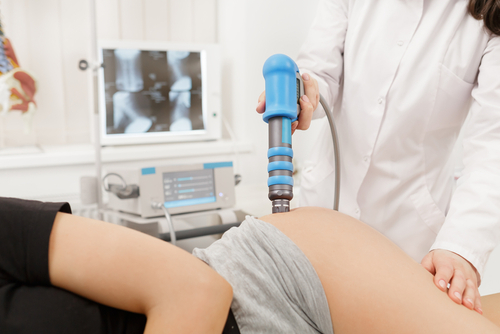 Extracorporeal Shockwave Therapy