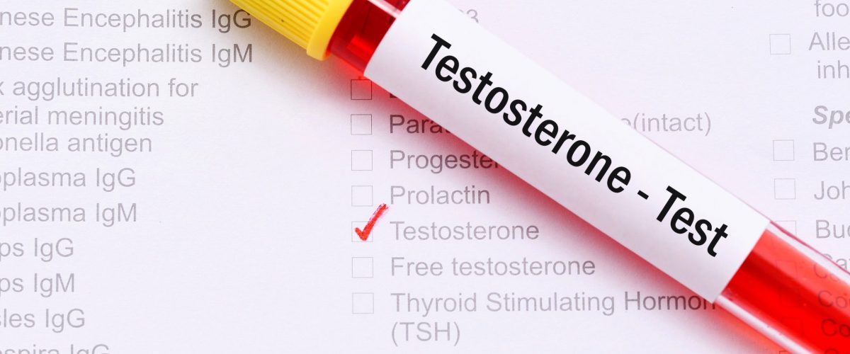 Testosterone Replacement Therapy